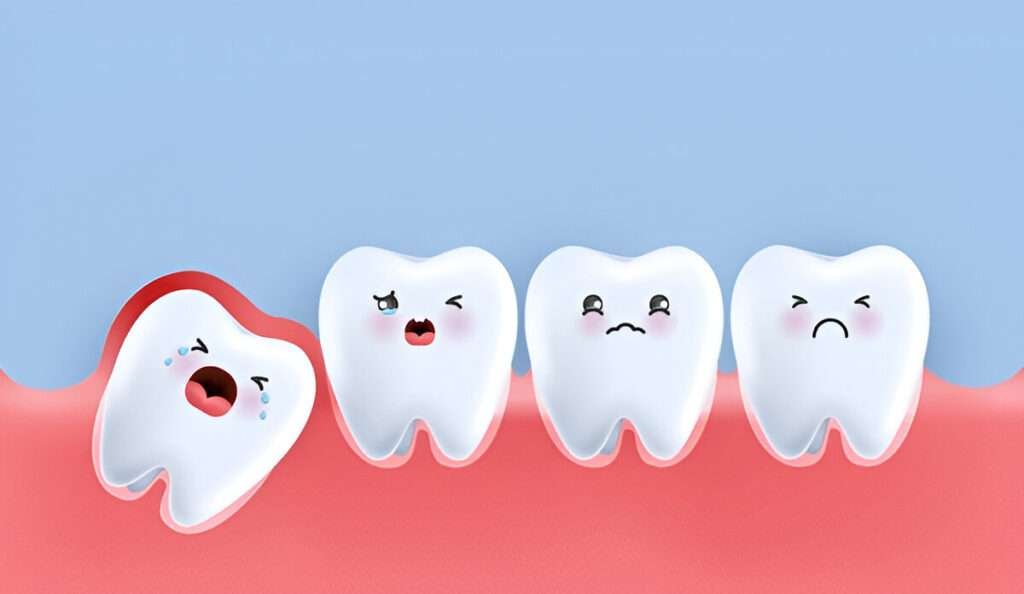 wisdom teeth extractions