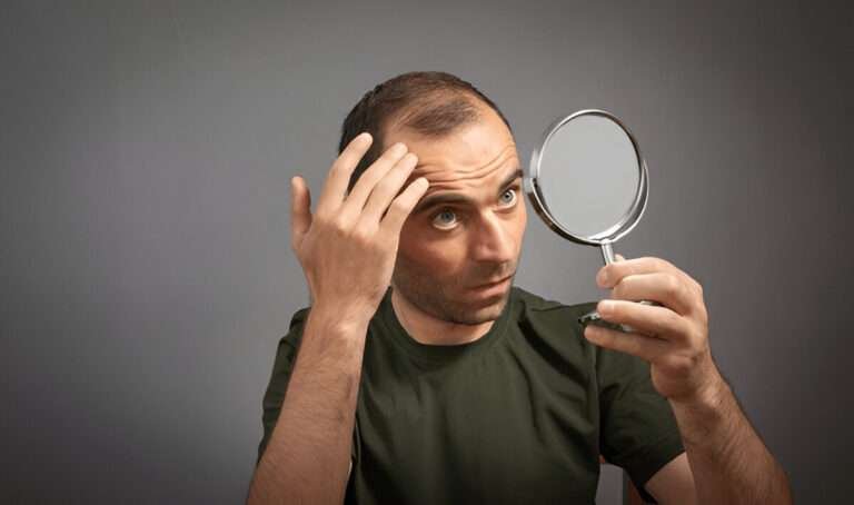Best Hair Transplant Clinics in London for Affordable Treatment
