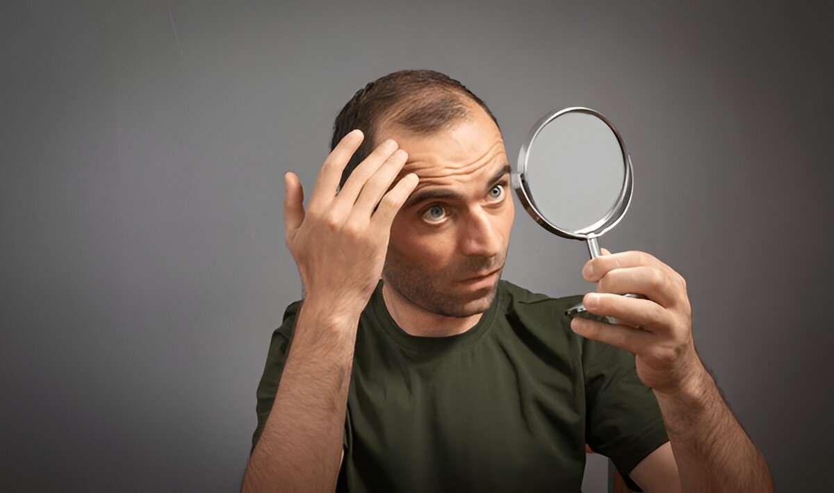 hair transplant UK