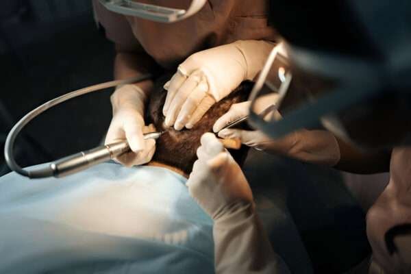Is Hair Transplant Surgery Right for You? Hair transplant London
