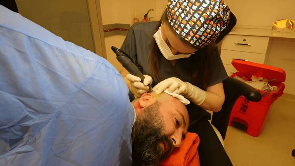 Hair Transplant
