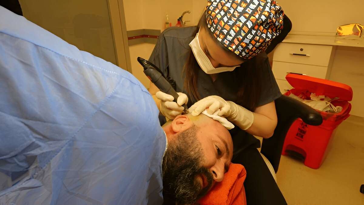 Hair Transplant