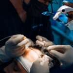 Hair Transplant
