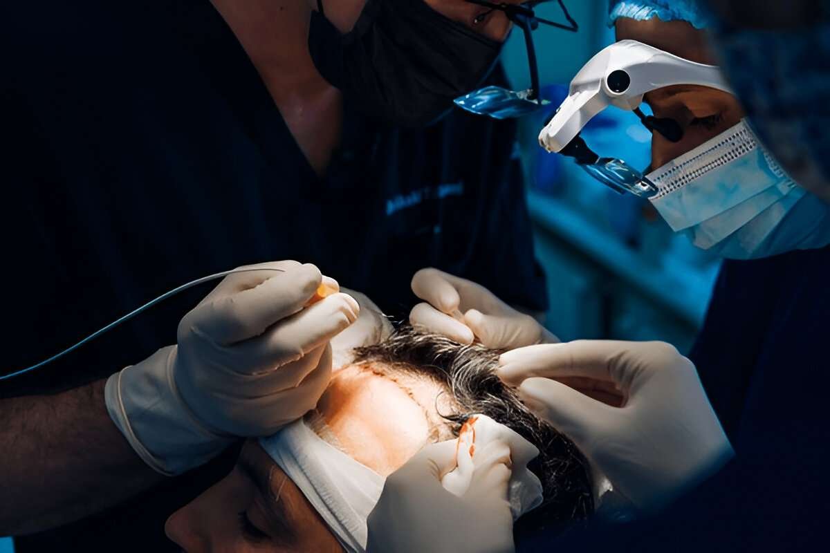 Hair Transplant