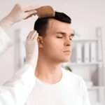 hair transplant Bristol