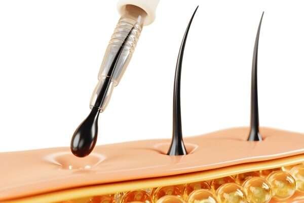 Hair Transplant Success Stories: Real UK Experiences Hair Transplant