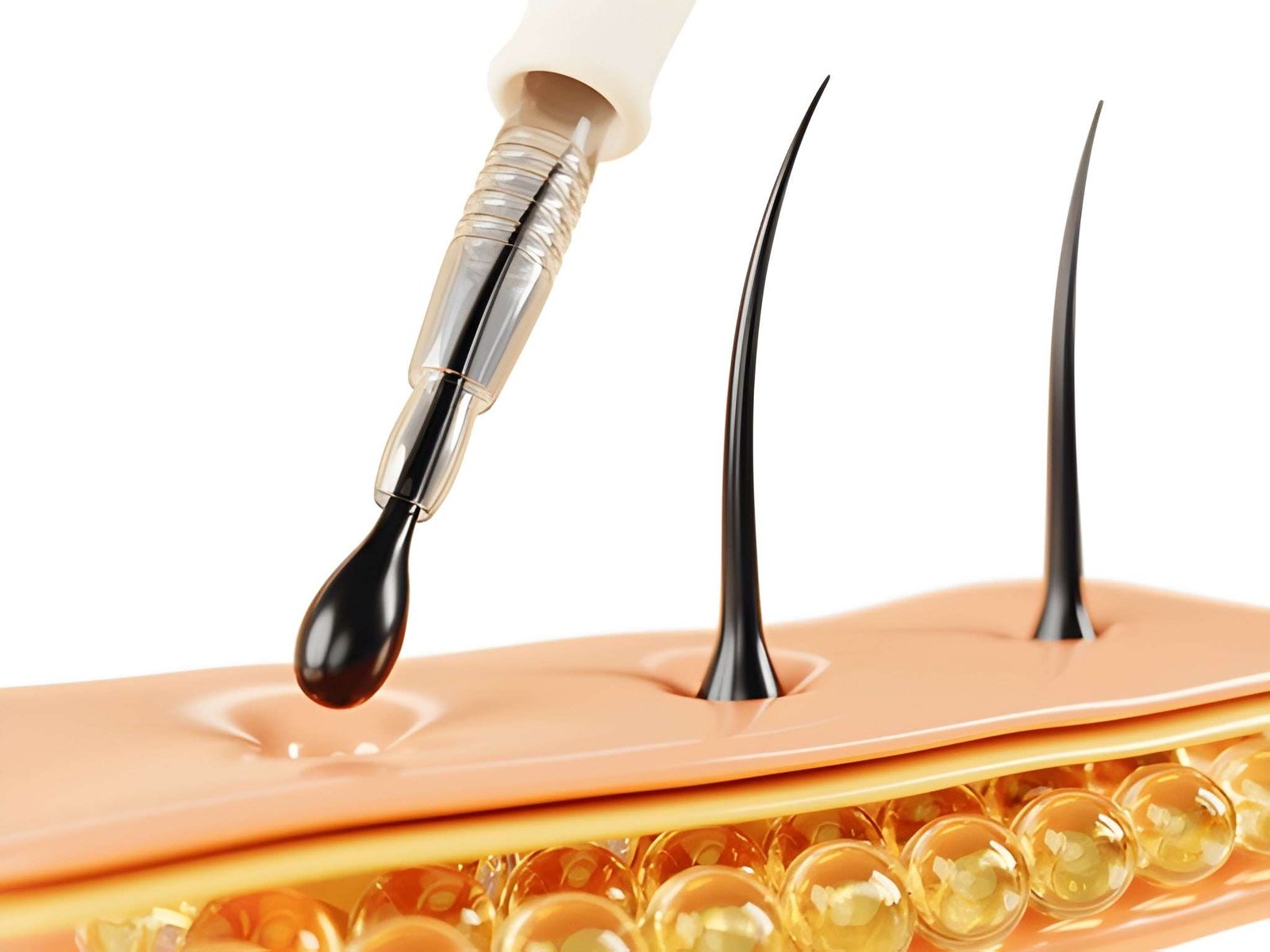 Hair Transplant