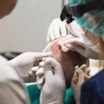 hair transplant UK