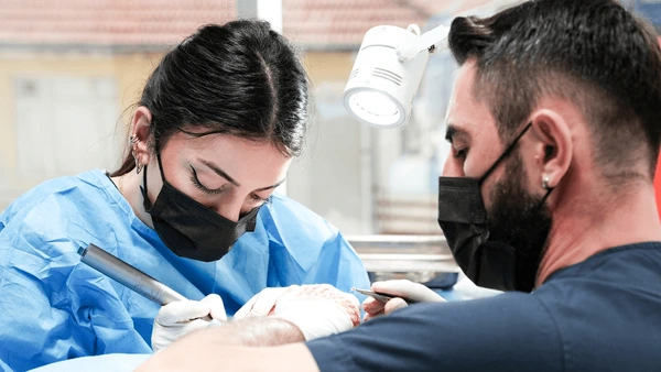 Hair Transplant