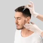 Hair Transplant