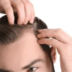hair loss treatment