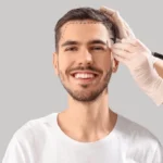 best age for hair transplant