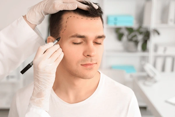 Jude Law hair transplant