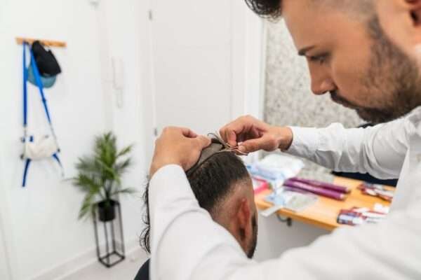 rob brydon hair transplant