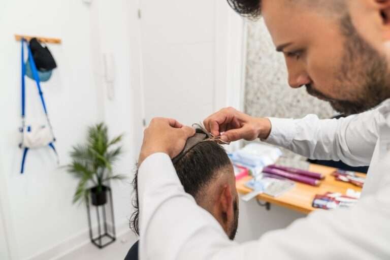 rob brydon hair transplant